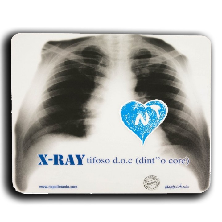 Souvenir Napoli - Tappetino mouse X-Ray Tifoso Doc | Napolimania